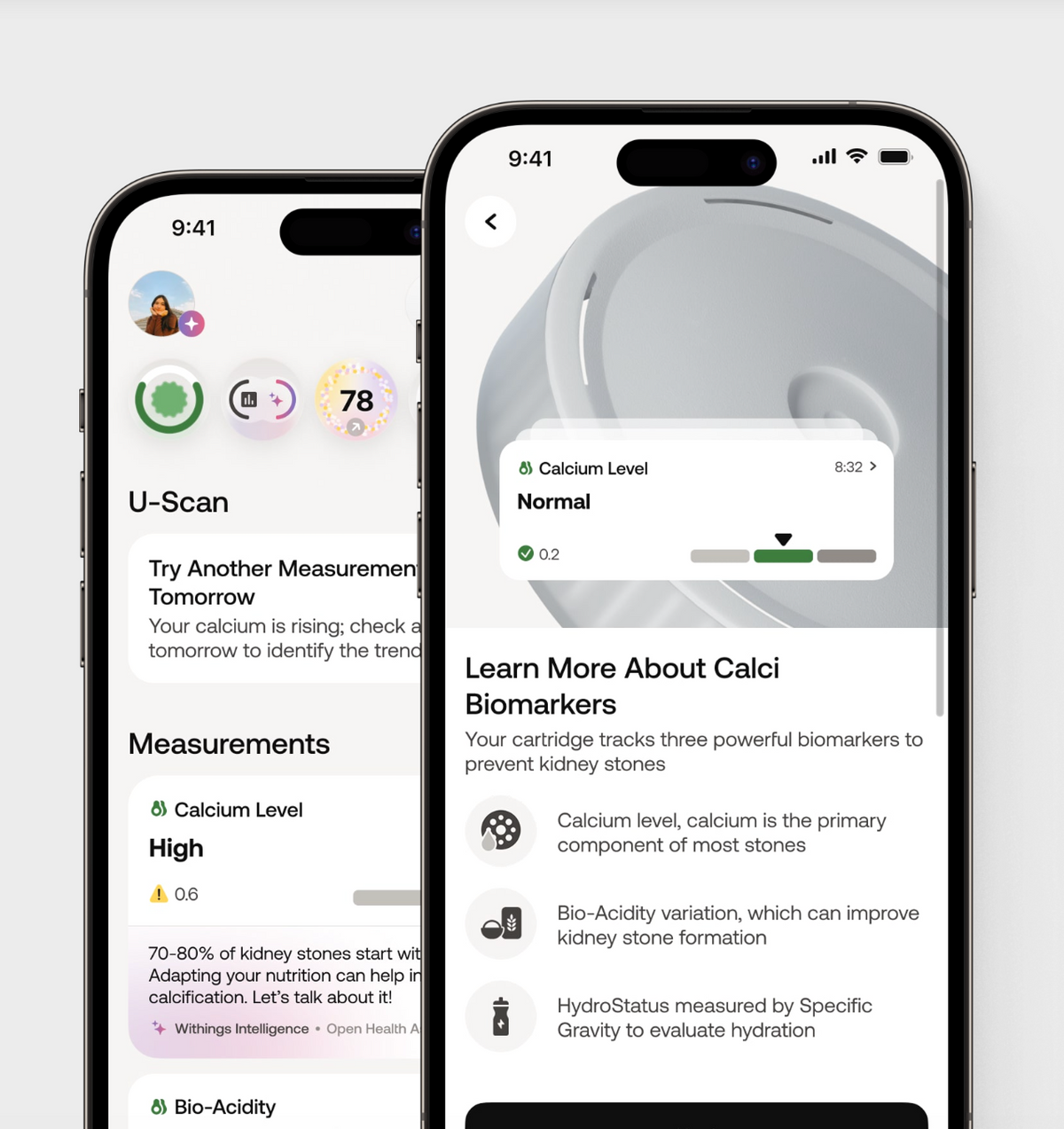 U-Scan Calci — App-skærm — To Health Mate-skærme der viser calciumindhold, bio-surhedsgrad og hydrerings-biomarkørdetaljer — mobil UI, urindata, målingsdetaljer