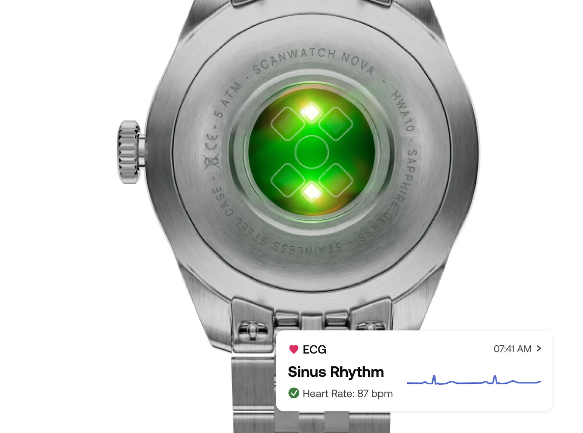 ScanWatch Nova Brilliant – Withings