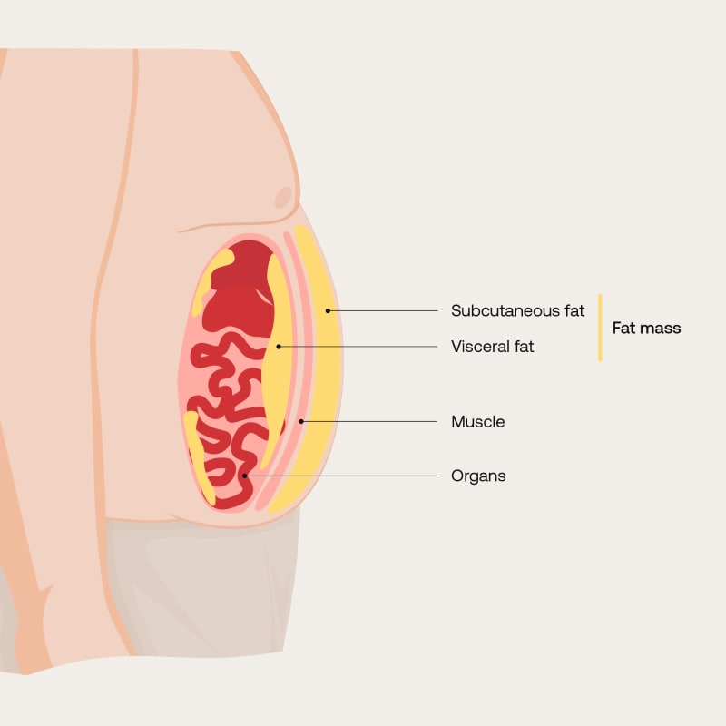 retatrutide and visceral fat Triple hormone receptor agonist for metabolic dysfunction-associated steatotic liver disease: a randomized phase 2a trial Retatrutide for Visceral Fat Loss
